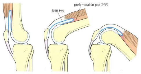 膝蓋上嚢による膝関節の可動制限 徒手療法を学べるセラピストのブログ