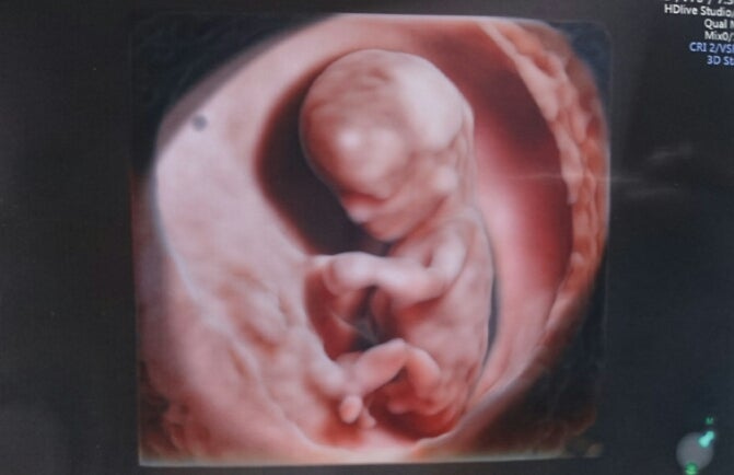 16 週 エコー 妊娠16週目で胎児の性別はわかる 判別する方法は マタニティフォトのポータルサイト Mamany のブログ