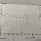 喘息、だってさ…(´ｰ｀)の記事より