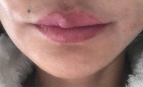 唇をピンクにするタトゥーリップの経過写真 レカルカコスメブログ