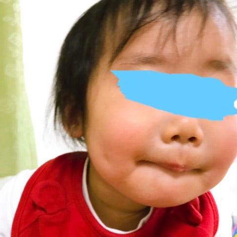 アレルギー検査で 卵白陽性 あれっくすまいる