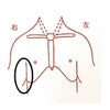胸部打撲の鍼灸治療の画像