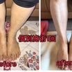 官足法個別施術〜自己治癒力免疫力をあげ体質改善する台湾式の足もみ官足法