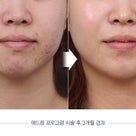 DA美容外科の皮膚科施術症例写真の記事より