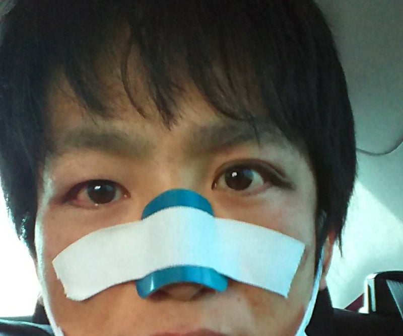 鼻骨骨折整復 術後翌日 本音しか言いません 廣中克至のブログ