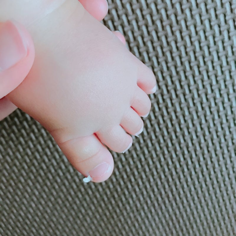 子供 足 の 爪 剥がれ た implussce