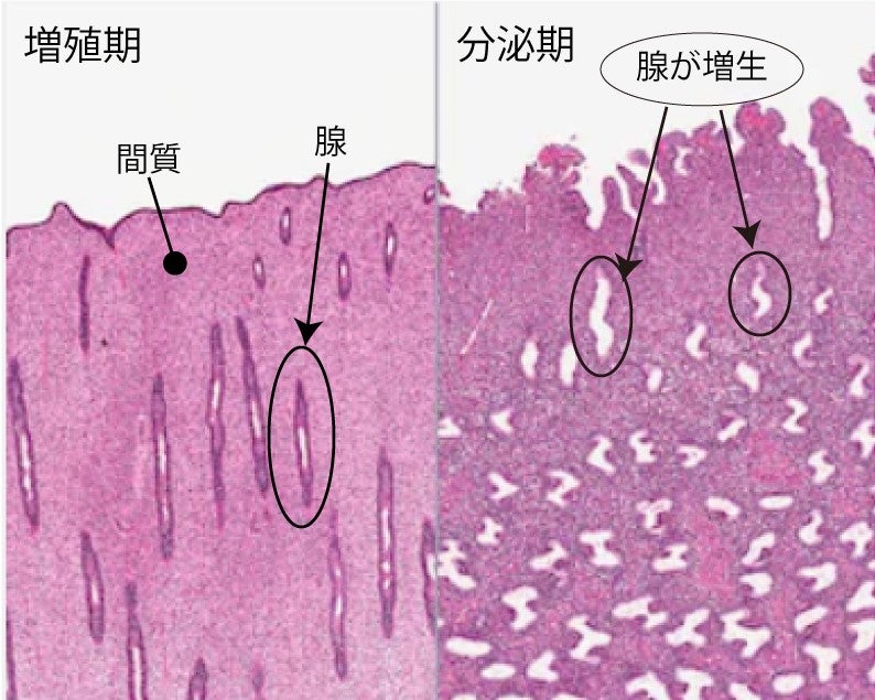 子宮 内 膜 増殖 症 症状