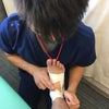 足首捻挫の画像