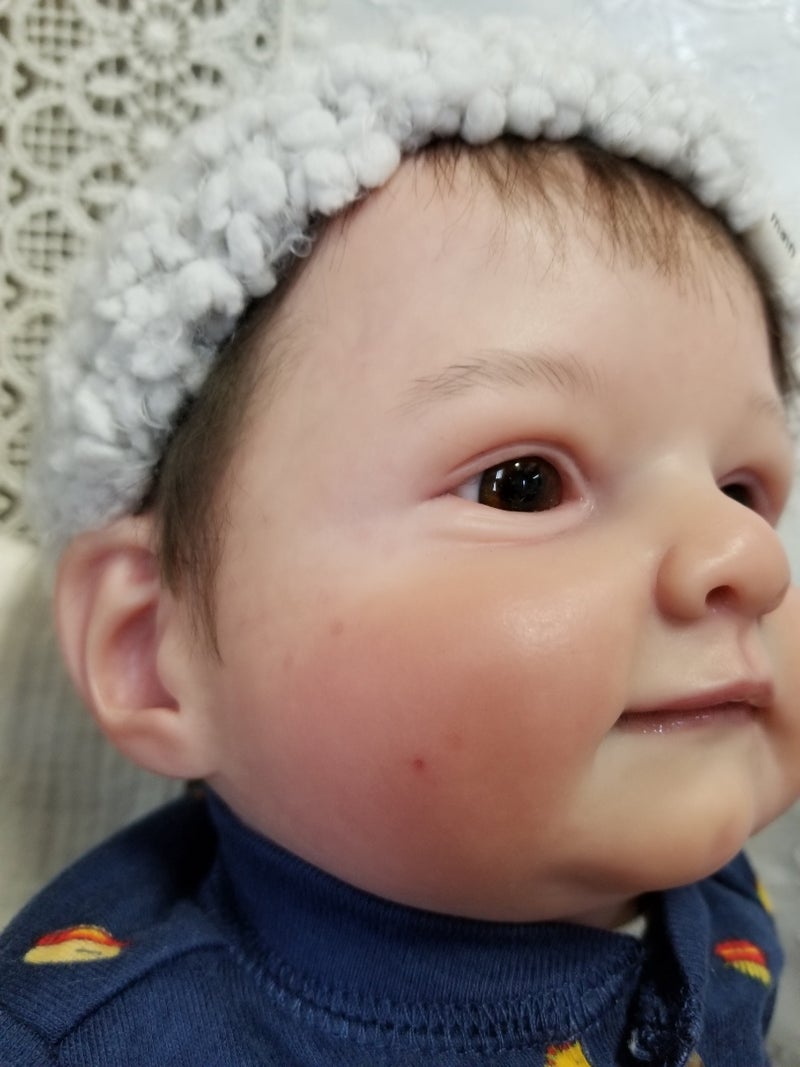 赤ちゃん 顔 シミ 268336赤ちゃん 顔 シミ レーザー