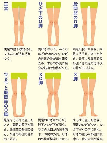 脚が太いのは遺伝 Kobami 3のブログ