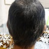 おハゲからの道　4ヶ月が過ぎましたの画像