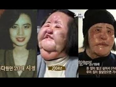 6561 整形依存症 韓国女性 温故痴人のブログ