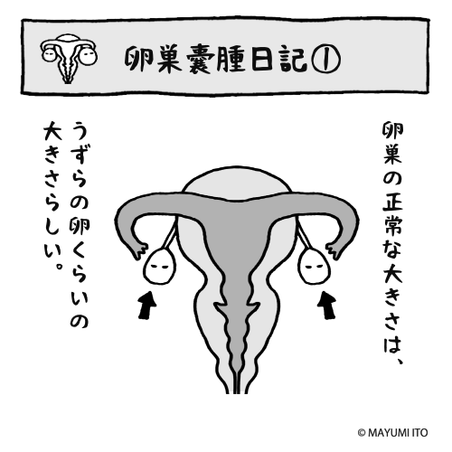 卵巣 嚢腫 と は