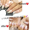 before♪after❤️の画像