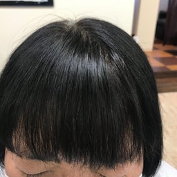 画像 増やしませんか（増毛） の記事より 5つ目