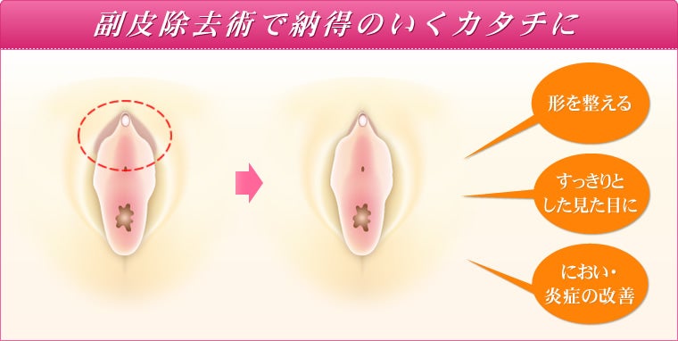 女性器をととのえる 美容整形外科医 福田ゆり香のブログ
