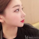 [韓国美容整形]鼻整形＆脂肪移植でオルチャンに変身♥ID美容外科リアルセルフィーグラムの記事より