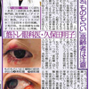 スポニチ　美女医が答えるリレーコラム「身近な目の病気『ものもらい』高齢者は要注意」の画像