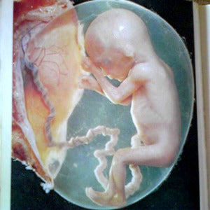 妊娠12週目の赤ちゃんは 人間そのもの 赤ちゃんの命を大切に スターシードの風