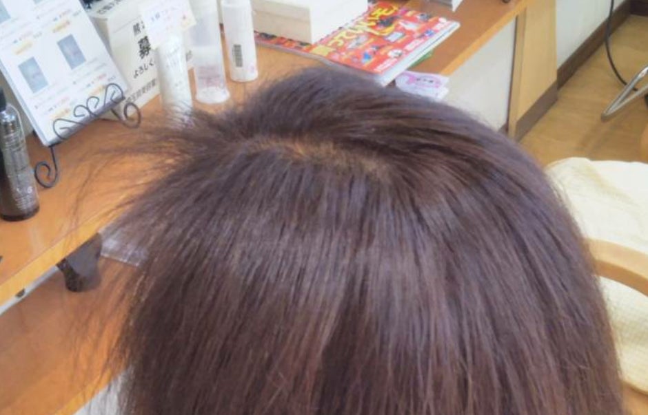 前髪が伸びない アホ毛が多い 意外な原因が 三郷市戸ヶ崎 髪と頭皮を大切にする美容室 セラヴィのブログ