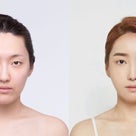 ［韓国美容整形］バノバキ美容外科のREAL STORY❤︎輪郭手術で小顔美人に大変身♡の記事より