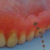 「入れ歯」の構造について教えて！の画像