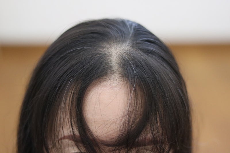 割れる 前髪 あきらめないで！パックリ割れる「前髪」のクセをなくす方法ー髪のお悩みやケア方法の解決ならコラム｜EPARKビューティー（イーパークビューティー）