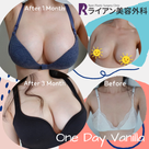 【Before/After】ライアン1Day豊胸で差が付くThe・イイ女‼の記事より