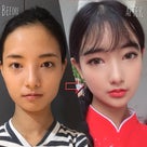 ［韓国美容整形］DA美容外科でチャイボーグ風に変身のREAL STORY♡の記事より