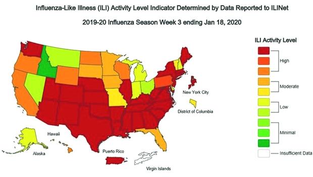 「米国で季節性インフルエンザ」の画像検索結果