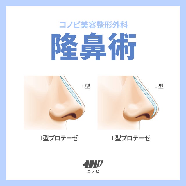 韓国鼻整形手術専門コノピ美容整形外科　ノジョンフン