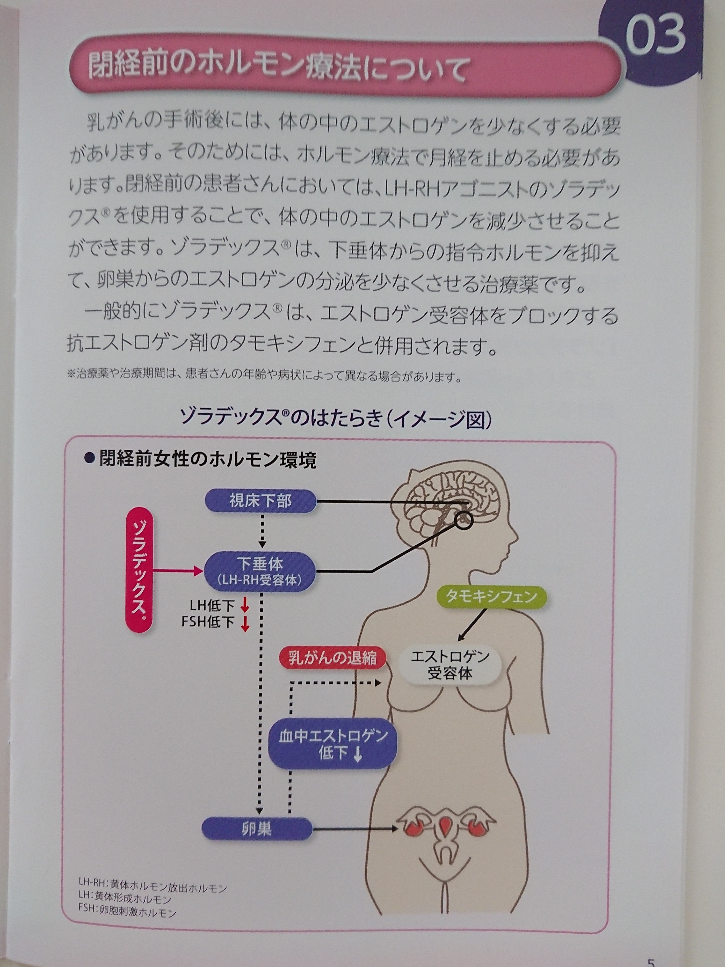 ゾラデックス　1回目の記事画像