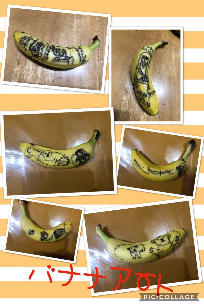 バナナ 結石 尿 管