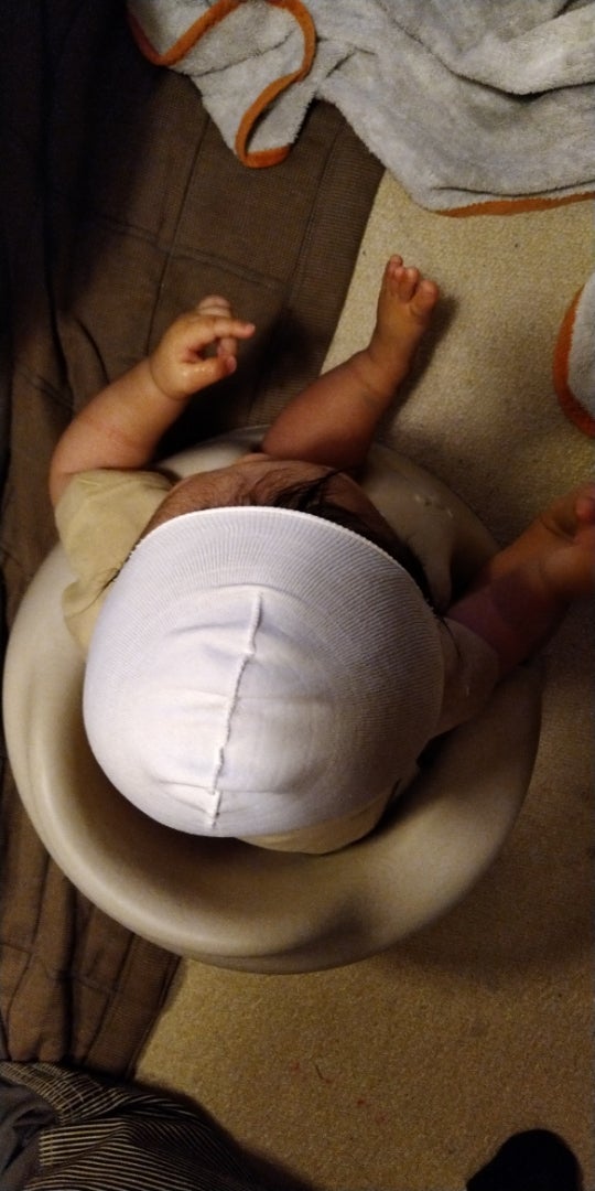 赤ちゃん斜頭症 短頭症 治療記録 ヘルメット装着２５日目 みぃらこぅ Toeic簡単得点アップ法 試験日に１００点up勉強法