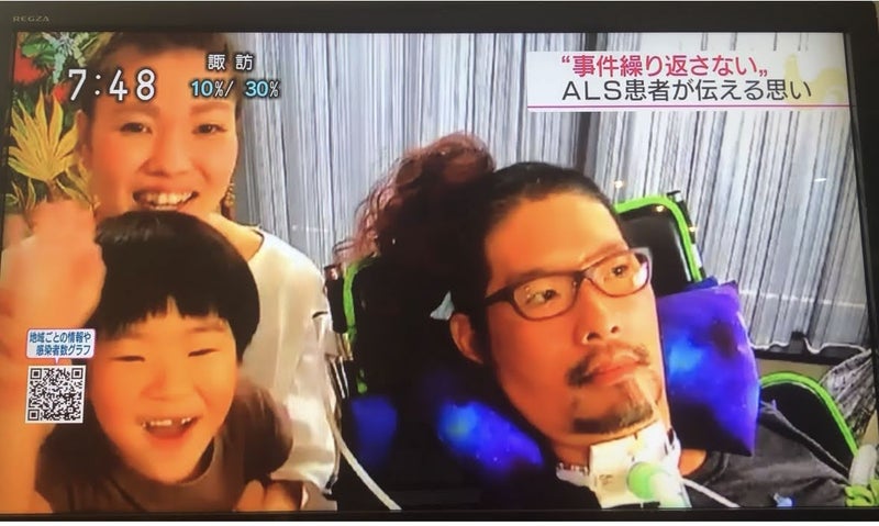 ｎｈｋ おはよう日本 Alsと生きていく 45歳 発症時 美容師 Shuu