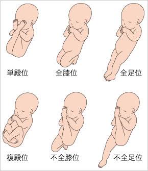 奇跡の出産 ソシアス美緒オフィシャルブログ ラテンな結婚生活 Powered By Ameba 奇跡の出産 ソシアス美緒オフィシャルブログ ラテンな結婚生活 Powered By Ameba