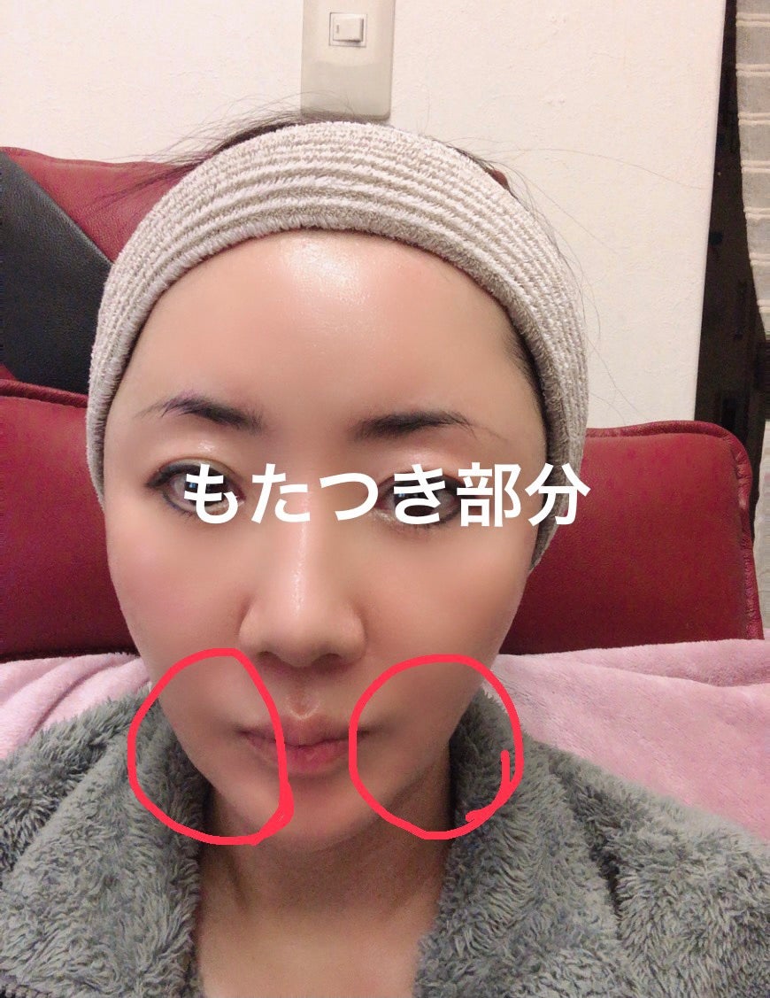 アザトマスクの効果!!お客様からの嬉しいご報告 | レカルカ アザトマスクの効果!!お客様からの嬉しいご報告 | レカルカ