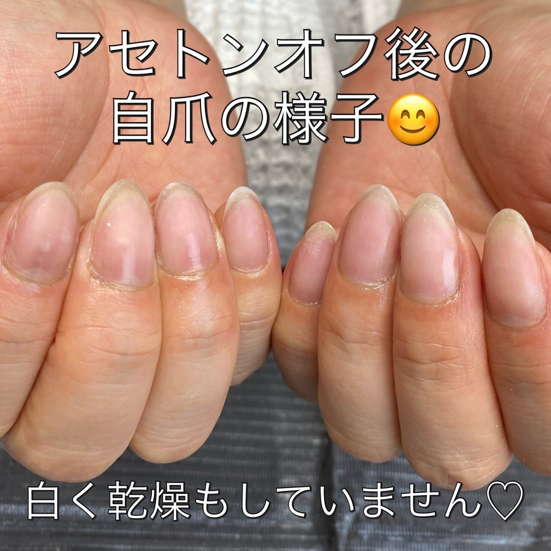 2年ぶりジェルオフ後の自爪の様子は 町田 成瀬ネイルサロン 爪を傷めず丁寧な甘皮ケアと上品で可愛いデザインが得意なロージーネイル 2年ぶりジェルオフ後の自爪の様子は 町田 成瀬ネイルサロン 爪を傷めず丁寧な甘皮ケアと上品で可愛いデザインが得意なロージーネイル