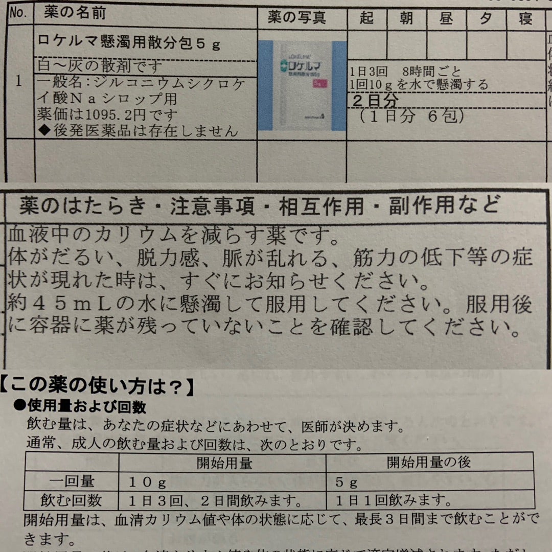 薬価 ロケルマ ロケルマ懸濁用散のメリットと注意点を解説｜KusuriPro