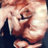 妊娠後期突入＆4Dエコーの画像