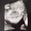 妊娠31週  小ちゃんの笑顔に救われる☺︎の画像
