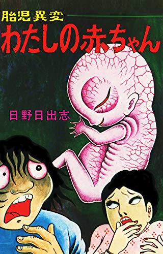蔵六の奇病 | ウルトラ馬鹿一代~そこに愛はあるのかい? 蔵六の奇病 | ウルトラ馬鹿一代~そこに愛はあるのかい?