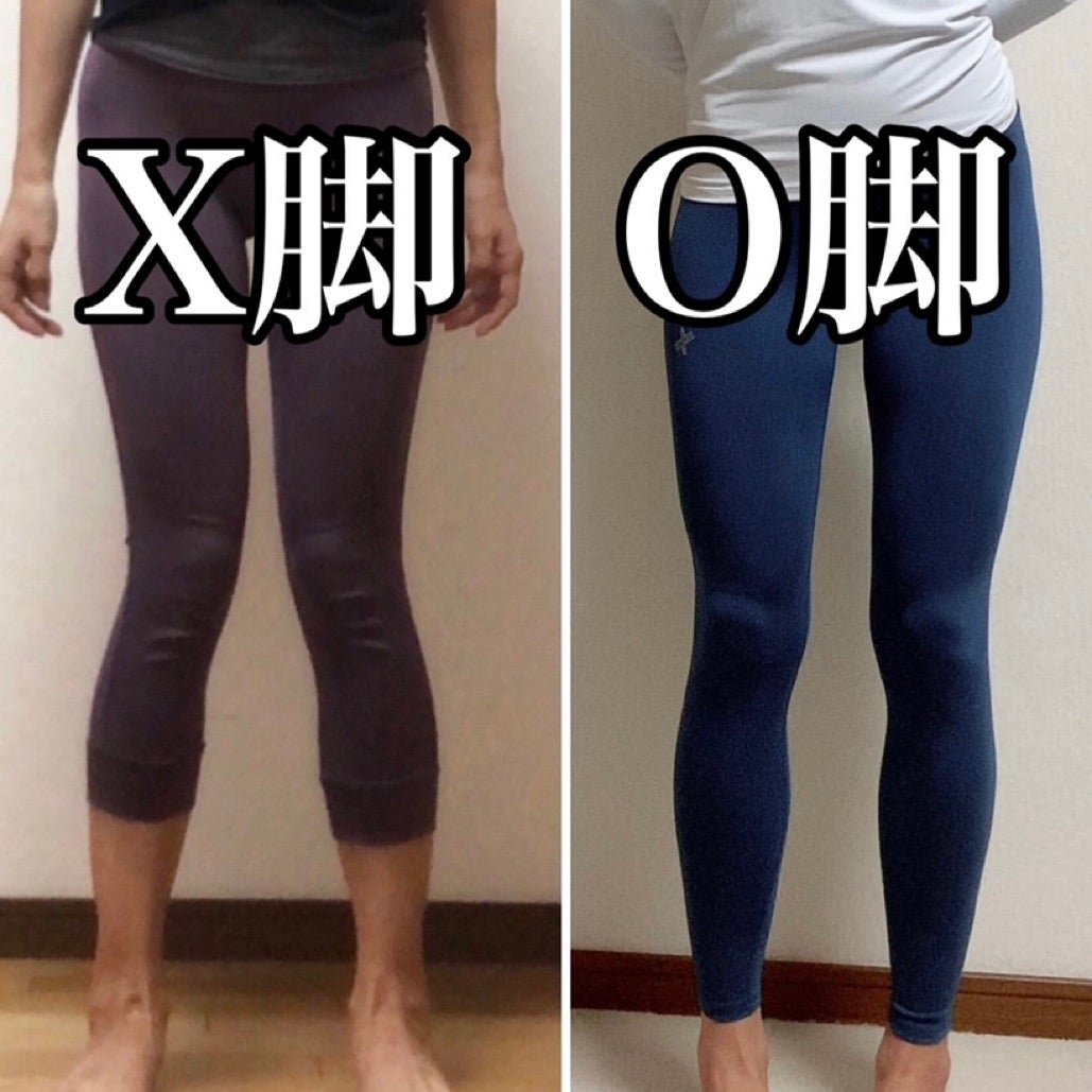 シャイニングゴールデン ストレグ ストレートレッグ O脚改善 美脚 脚
