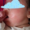 乳児湿疹におすすめの保湿剤の画像