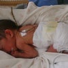 入院中の赤ちゃんの脳を育む。発達促進タッチケアのご紹介の画像
