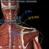 首・肩の治療ポイント②肩甲背神経の画像