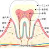 歯原病の画像
