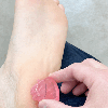 足底筋膜炎のリハビリ①の画像