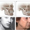 お顔の加齢プロセスの画像