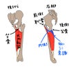 ターンアウトの内転筋は骨盤の位置がポイントの画像